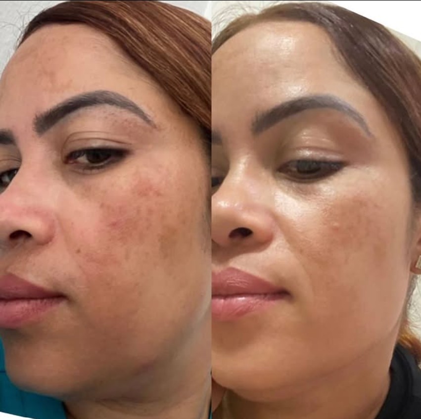 Transformation de Léana