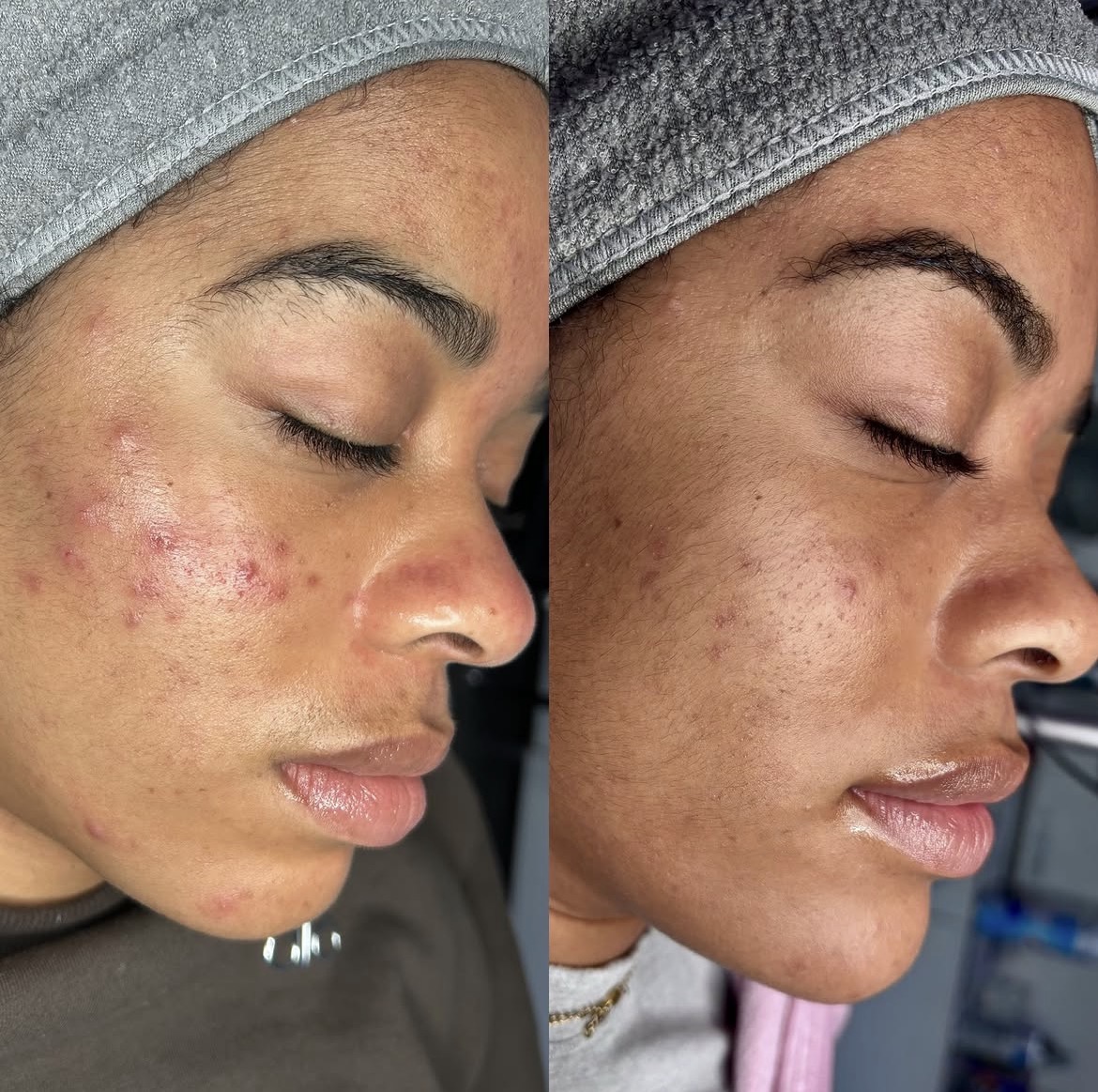 Transformation de Marie